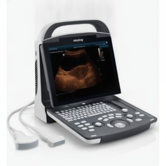 Portable Obstetric Ultrasound Machine with 2 Probes – supplied in Nairobi